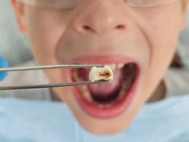 Best 24-Hour Emergency Dentist in Ettrick, VA